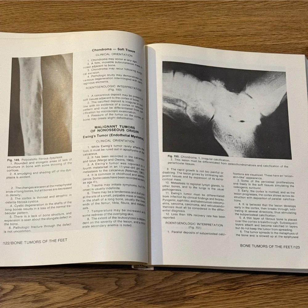 N/A clinical foot